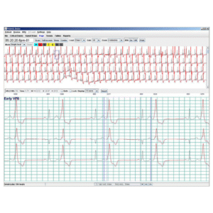 Grabadora Holter de presión arterial IEM Mobi O'Graph — Monitoreo ambulatorio